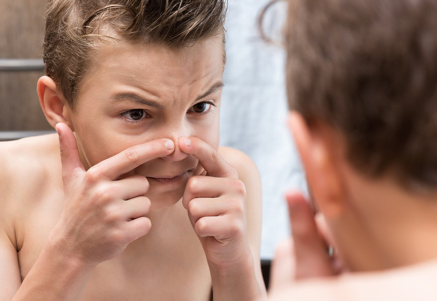 Congested skin and teenagers